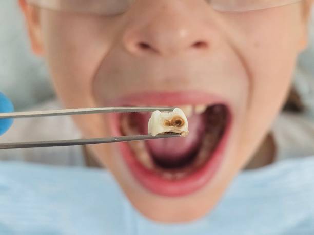 Best Emergency Tooth Extraction  in Sandy Springs, GA