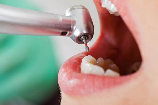 Best Emergency Dentist Near Me  in Sandy Springs, GA